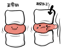 腰椎间盘突出疼痛难忍却不想手术？让中医小针刀帮你摆脱痛苦吧！
