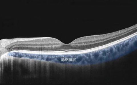 莫廷全自动眼病筛查仪MasterOCT Ⅱ精彩亮相Retina China 2023