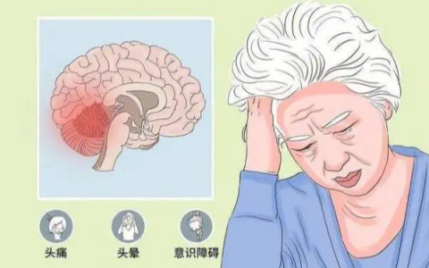 万万没想到！小脑萎缩病情是这样一步一步稳定下来的！